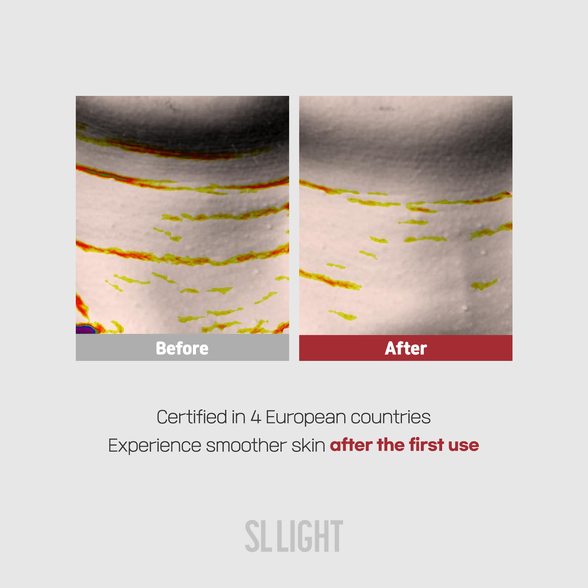 Retinal Age-Reset Neck Patch