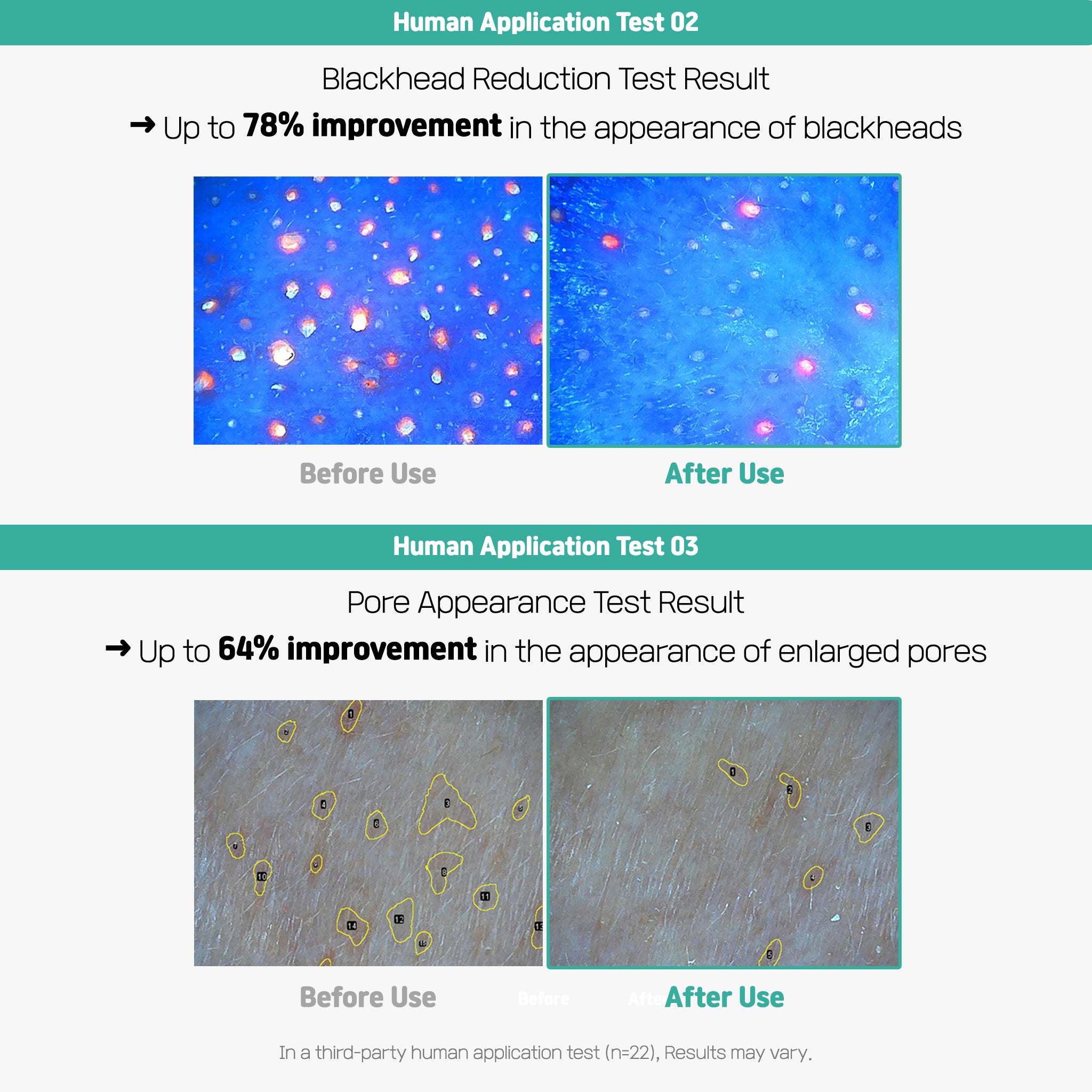 Centella Poreless Patch