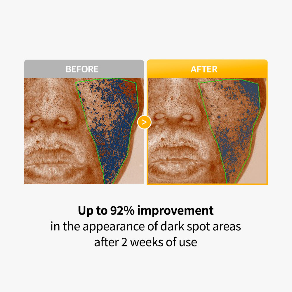 Arvitathion Brithoning Cream & Patch Duo