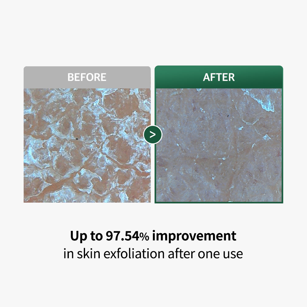 Heartleaf Peelief Clear Gel